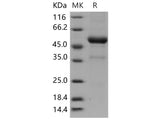 Recombinant Mouse KLRB1F/NKR-P1F Protein (Fc Tag)