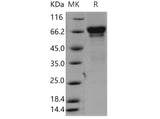 Recombinant Mouse 4-1BB/TNFRSF9 Protein (aa 1-211, Fc Tag)(Active)