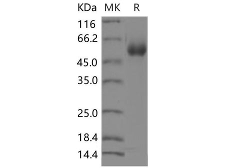 Recombinant Mouse CD123/IL3RA Protein (ECD, His Tag)