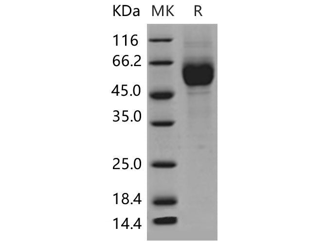 Recombinant Mouse IL1R1/CD121a Protein (His Tag)(Active)