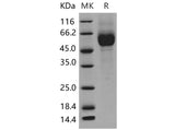 Recombinant Mouse IL1R1/CD121a Protein (His Tag)(Active)