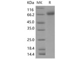Recombinant Mouse IL1R1/CD121a Protein (Fc Tag)(Active)