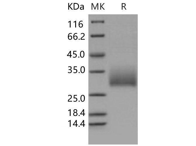 Recombinant Mouse NKR-P1A/Klrb1a Protein (His Tag)