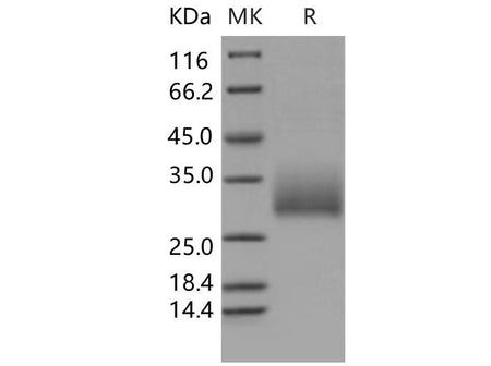 Recombinant Mouse NKR-P1A/Klrb1a Protein (His Tag)