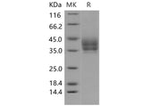 Recombinant Mouse B7-DC/PD-L2/CD273 Protein (His Tag)(Active)