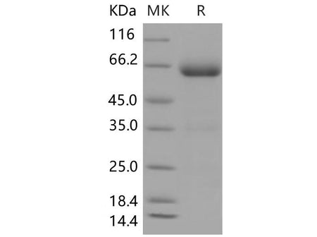 Recombinant Mouse B7-DC/PD-L2/CD273 Protein (Fc Tag)(Active)