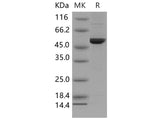 Recombinant Mouse DOPA Decarboxylase/DDC Protein (His Tag)