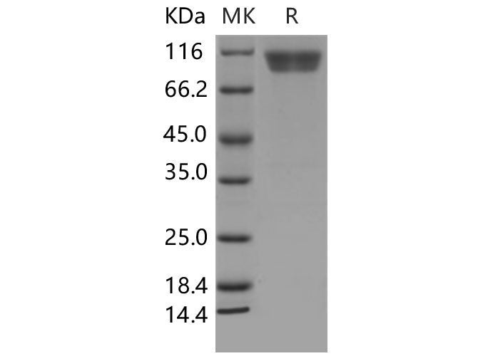 Recombinant Mouse CD146/MCAM Protein (His Tag)