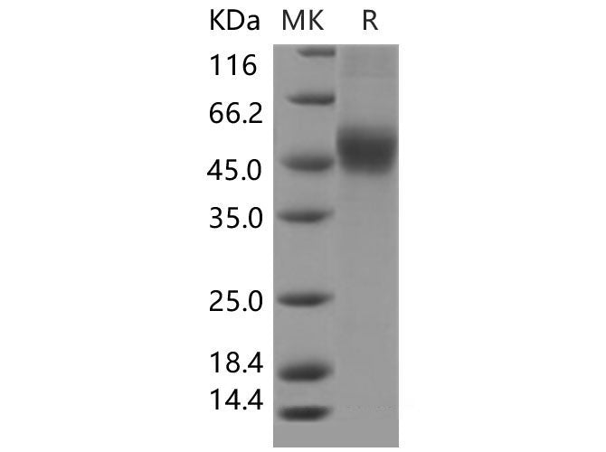 Recombinant Mouse CD122/IL-2RB Protein (His Tag)
