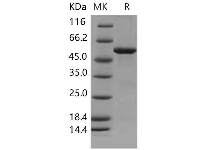 Recombinant Mouse SPG21 Protein (His & GST Tag)