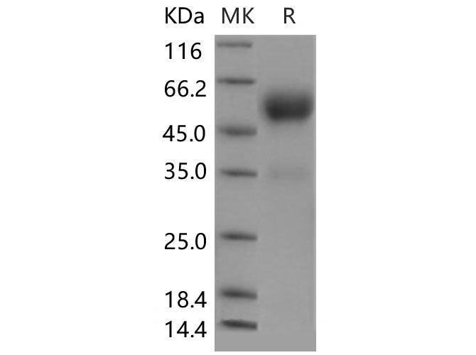 Recombinant Mouse Frizzled-5/FZD5 Protein (Fc Tag)