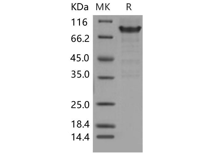Recombinant Mouse PSGL-1/CD162 Protein (aa 1-307, Fc Tag)