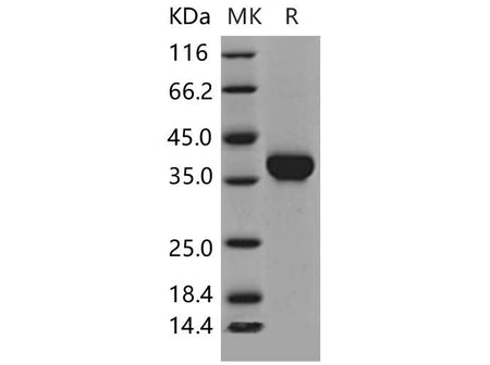 Recombinant Mouse Carbonic Anhydrase X/CA10 Protein (His Tag)(Active)