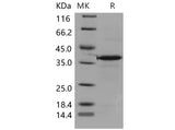 Recombinant Mouse Carbonic Anhydrase VIII/CA8 Protein (His Tag)(Active)