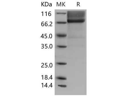 Recombinant Mouse Biglycan/BGN Protein (Fc Tag)