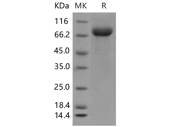Recombinant Mouse LILRB3/LIR3/ILT5/CD85a Protein (His Tag)