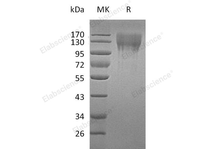 Recombinant Mouse CD96 Protein (His Tag)(Active)