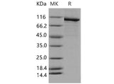 Recombinant Mouse PARP-1 Protein (His Tag)(Active)