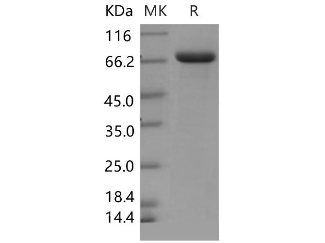 Recombinant Mouse Lactotransferrin/LTF Protein (His Tag)