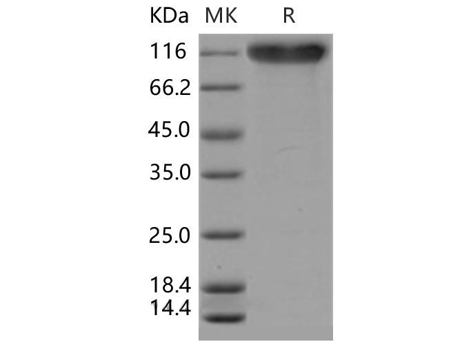 Recombinant Mouse SELP/selectin P/P-selectin Protein (His Tag)(Active)