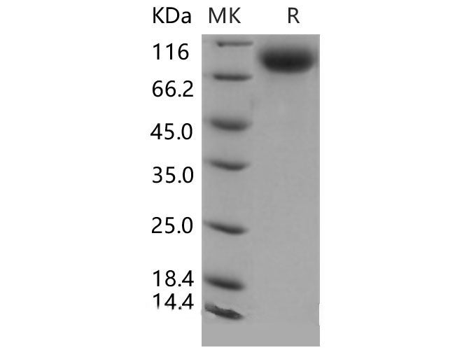 Recombinant Mouse E-Selectin/SELE Protein (His Tag)(Active)