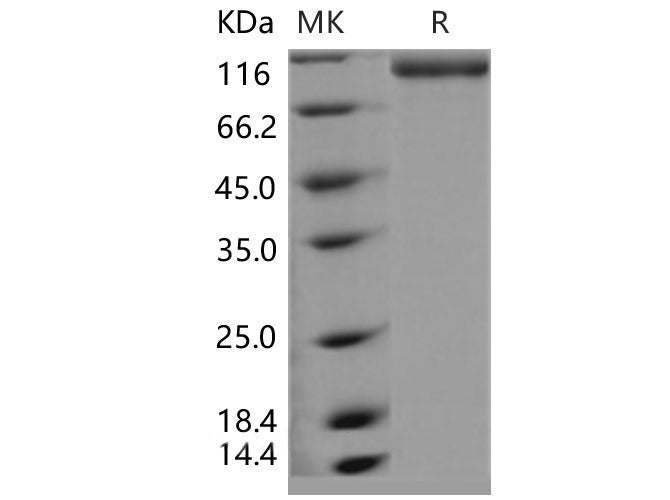 Recombinant Mouse E-Selectin/SELE Protein (Fc Tag)(Active)