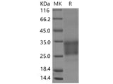 Recombinant Mouse CD69 Protein (His tag, ECD)