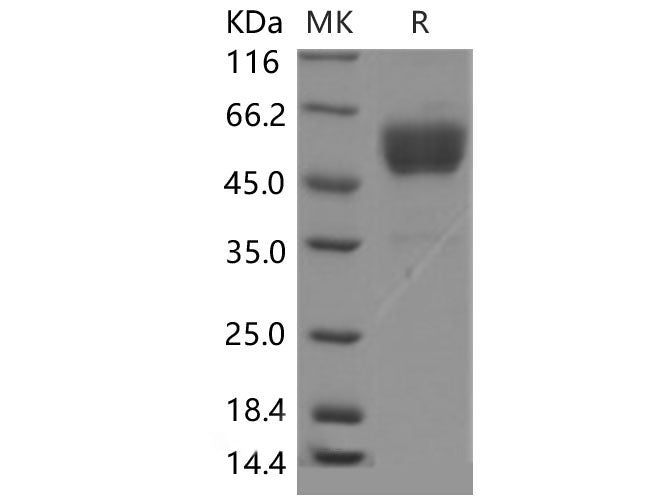 Recombinant Mouse CD69 Protein (Fc tag, ECD)