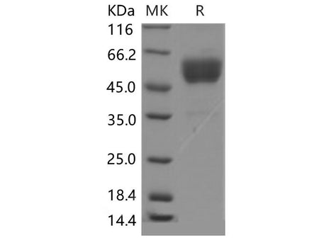 Recombinant Mouse CD69 Protein (Fc tag, ECD)