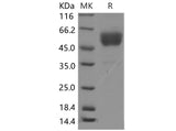 Recombinant Mouse CD69 Protein (Fc tag, ECD)