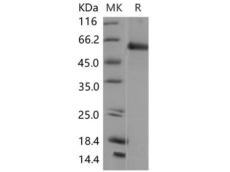 Recombinant Mouse Smad5 Protein