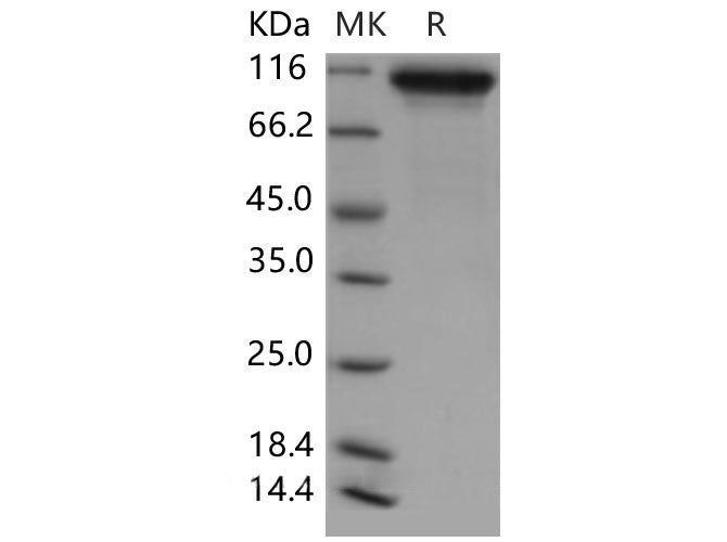 Recombinant Mouse Neuroligin 1/NLGN1 Protein (His Tag)