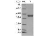 Recombinant Mouse CD59a/MAC-IP Protein (Fc Tag)