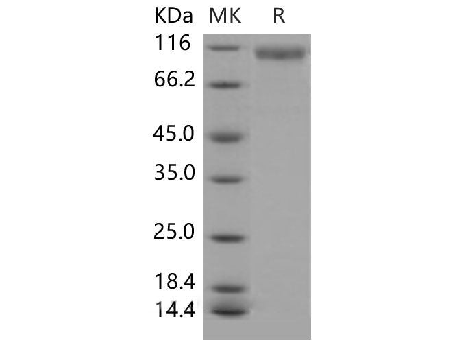 Recombinant Mouse HER2/ErbB2 Protein (His Tag)