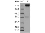 Recombinant Mouse CD45/PTPRC Protein (Fc Tag)(Active)