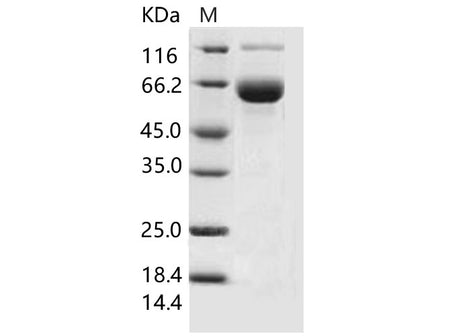 Recombinant Mouse SIGLEC3/CD33 Protein (Fc Tag)