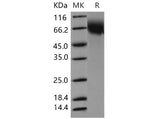 Recombinant Mouse CD6/TP120 Protein (His Tag)(Active)