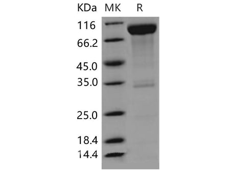 Recombinant Mouse CD6/TP120 Protein (Fc Tag)(Active)