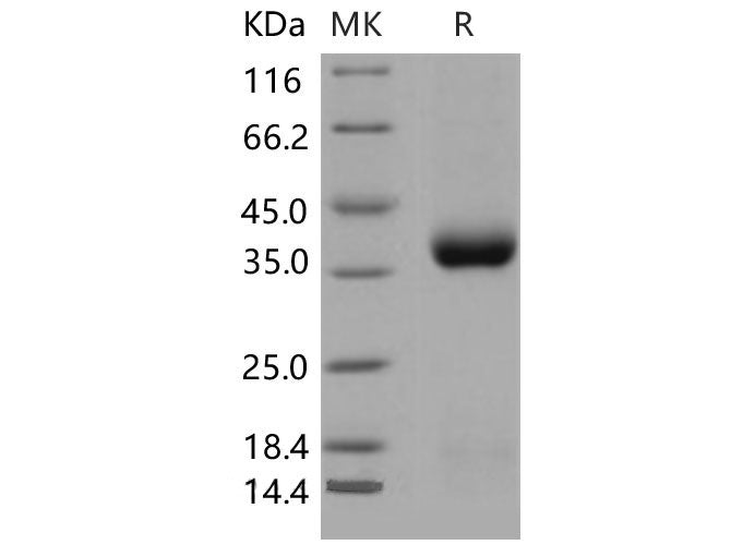 Recombinant Mouse CLEC10A/CD301 Protein (His Tag)