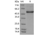 Recombinant Mouse CD302/CLEC13A Protein (Fc Tag)