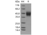 Recombinant Mouse IFNGR1/CD119 Protein (His Tag)(Active)