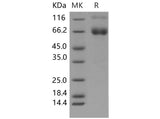 Recombinant Mouse IFNGR1/CD119 Protein (Fc Tag)(Active)