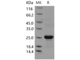 Recombinant Mouse CLEC3B/Tetranectin Protein (His Tag)
