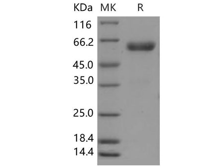 Recombinant Mouse CHODL/Chondrolectin Protein (Fc Tag)
