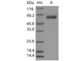 Recombinant Mouse CHODL/Chondrolectin Protein (Fc Tag)