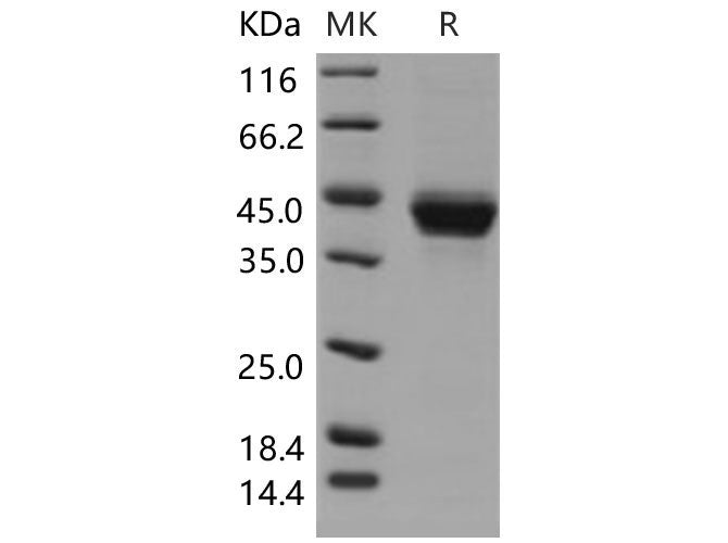 Recombinant Mouse CD23 Protein (His Tag)