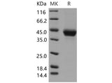 Recombinant Mouse CD23 Protein (His Tag)