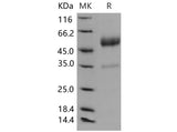 Recombinant Mouse CD83/HB15 Protein (aa 1-133, Fc Tag)