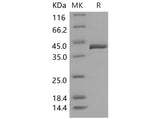 Recombinant Mouse TCN2 Protein (His Tag)