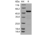 Recombinant Mouse 14-3-3 epsilon/YWHAE Protein (GST Tag)
